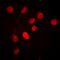 Anti-C/EBP beta (Phospho-T235) Antibody