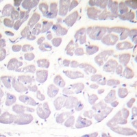 Anti-IKK alpha/beta (Phospho-S176/177) Antibody