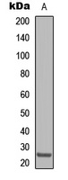 Claudin 8 Rabbit Polyclonal Antibody