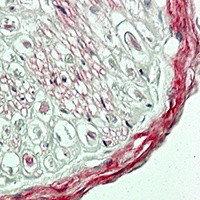 Collagen IV antibody