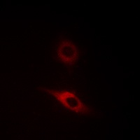 Anti-Collagen 4 alpha 2 Antibody