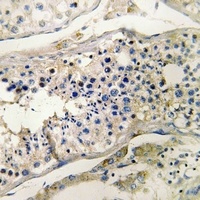 Anti-CUBN Antibody
