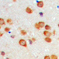 Cytochrome (phospho-450 2C19) antibody