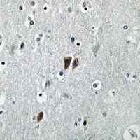 C17 antibody