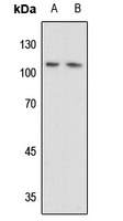 DAXX Antibody