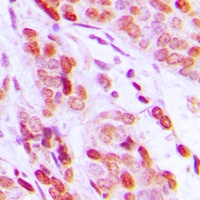 Anti-DAXX Antibody