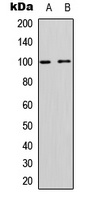 CD167a Rabbit Polyclonal Antibody
