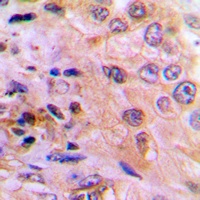 Anti-DUSP6 Antibody