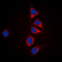Anti-DUSP6 Antibody