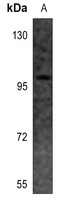 EEF2K Antibody [KO/KD Validated]