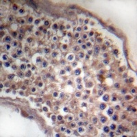Anti-Ephrin B1/2 Antibody