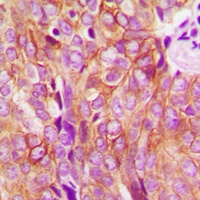 Anti-EGFR Antibody