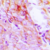 EGFR Antibody
