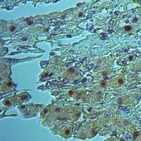 Anti-EIF3K Antibody
