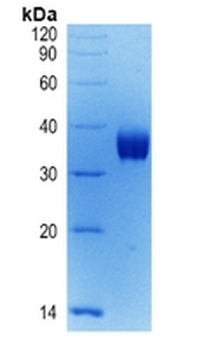 Recombinant COVID-19 S Protein RBD (BF.7)