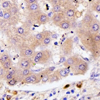KIF13B Rabbit Polyclonal Antibody