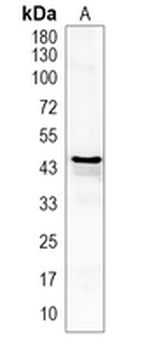 ATAT1 Rabbit Polyclonal Antibody