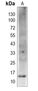 SAA2 Rabbit Polyclonal Antibody