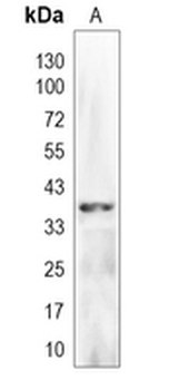 PDLIM2 Rabbit Polyclonal Antibody