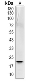 CITED4 Rabbit Polyclonal Antibody