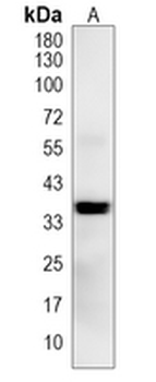 ST3GAL1 Rabbit Polyclonal Antibody