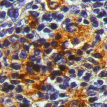 ST3GAL1 Rabbit Polyclonal Antibody