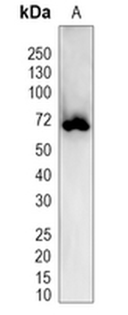 KCNK5 Rabbit Polyclonal Antibody