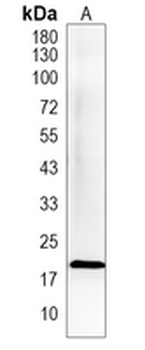TMEM238 Rabbit Polyclonal Antibody