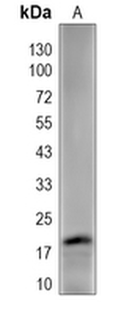 MT-ND6 Rabbit Polyclonal Antibody