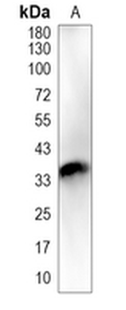 ALX1 Rabbit Polyclonal Antibody