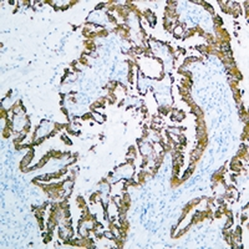 Cytokeratin-pan Mouse Monoclonal Antibody