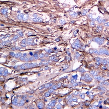Fibronectin Rabbit Monoclonal Antibody