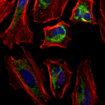 Fibronectin Rabbit Monoclonal Antibody