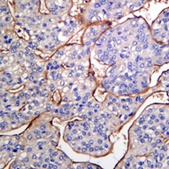 Laminin beta 1 Rabbit Monoclonal Antibody