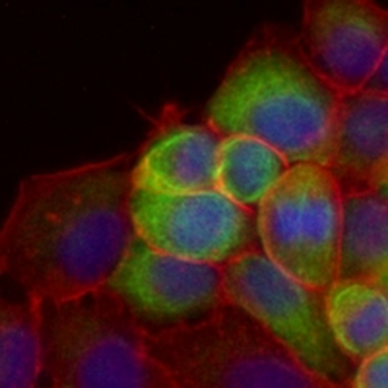 Laminin beta 1 Rabbit Monoclonal Antibody