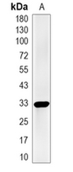 DOHH Rabbit Monoclonal Antibody