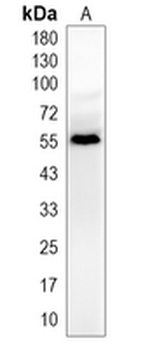 RBMY1A1 Rabbit Monoclonal Antibody