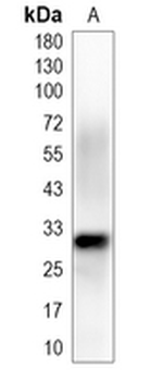 SLBP Rabbit Monoclonal Antibody