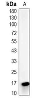 CLEC2B Rabbit Monoclonal Antibody