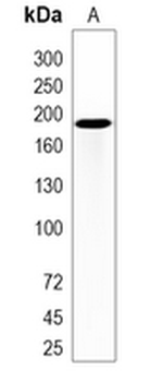 TIAM2 Rabbit Monoclonal Antibody