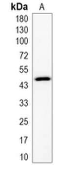 PDSS1 Rabbit Monoclonal Antibody