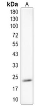 RAB7B Rabbit Monoclonal Antibody