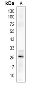 TSPAN4 Rabbit Monoclonal Antibody