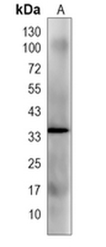 MTX3 Rabbit Monoclonal Antibody