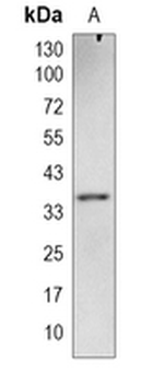 DBX2 Rabbit Monoclonal Antibody