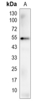 TMEM161B Rabbit Monoclonal Antibody