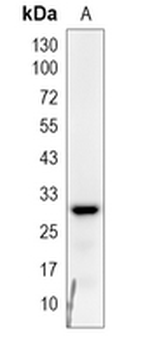 SLC25A26 Rabbit Monoclonal Antibody