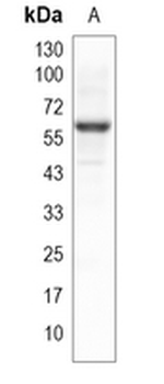 ABHD16A Rabbit Monoclonal Antibody