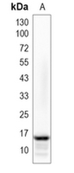 LGALS14 Rabbit Monoclonal Antibody