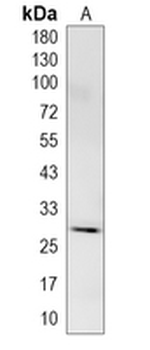 KCTD21 Rabbit Monoclonal Antibody